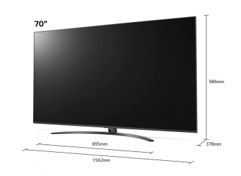 70" LED TV LG 70UP81006LA, Black (3840x2160 UHD, SMART TV, DVB-T2/C/S2)